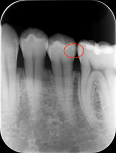 dental01