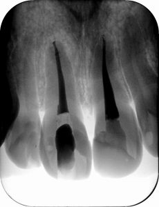 intraoral_2016gjk1203122612